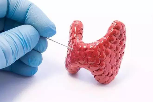 甲状腺疾病，包括甲状腺功能减退和甲状腺功能亢进，自古以来就是反复被医学研究人员研究的疾病
