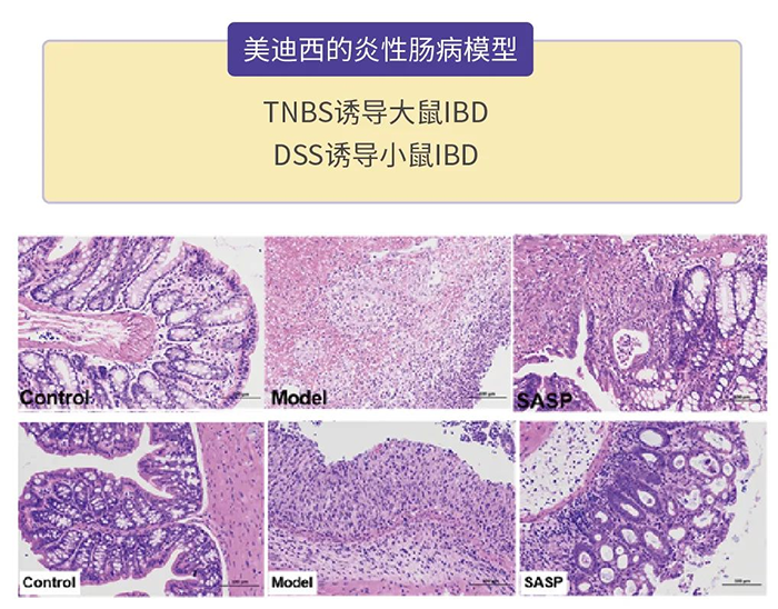 尊时凯龙的炎性肠病模型.png 尊时凯龙的炎性肠病模型.png